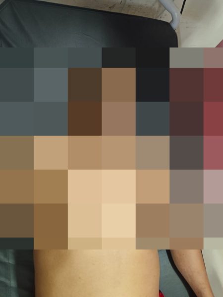 PENGANIAYAAN BRUTAL YANG DILAKUKAN OLEH SEKELOMPOK OKNUM PREMAN PADA SEORANG WARGA ACEH DI JAKPUS BEBERAPA WAKTU LALU, AKHYAR KAMIL ANGKAT BICARA.